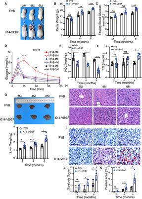 Gut Microbiota Dysbiosis and Altered Bile Acid Catabolism Lead to Metabolic Disorder in Psoriasis Mice